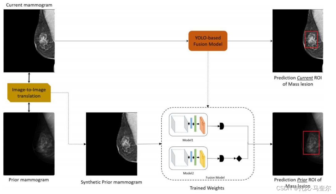 5.31.15 使用图像到图像转换和 YOLO 技术对先前的乳房 X 光检查结果中的异常进行早期检测和分类插图(3)