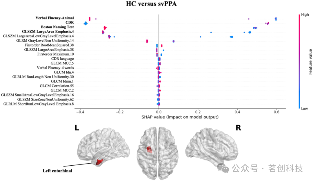 用于原发性进行性失语症分类的可解释性机器学习影像组学模型插图(4)