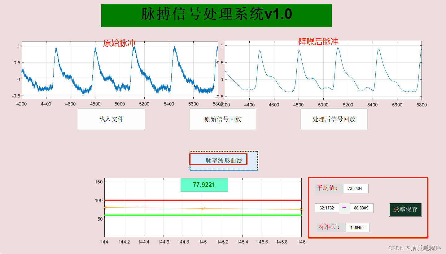 275 基于matlab的脉搏信号处理GUI界面编程插图