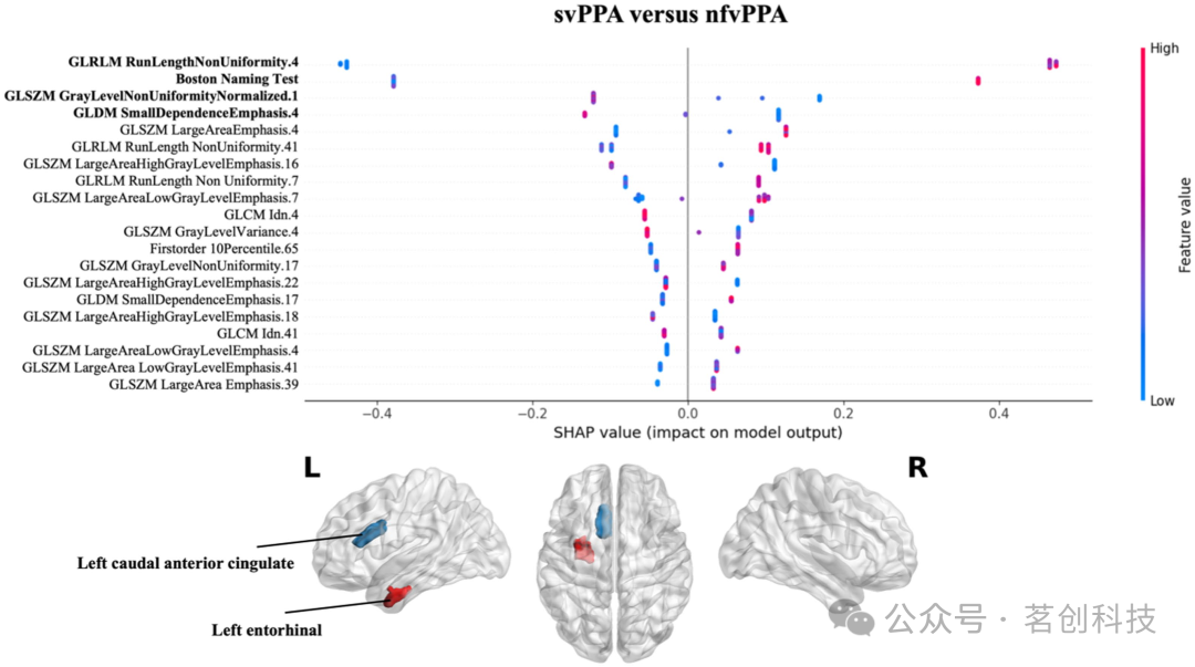 用于原发性进行性失语症分类的可解释性机器学习影像组学模型插图(6)