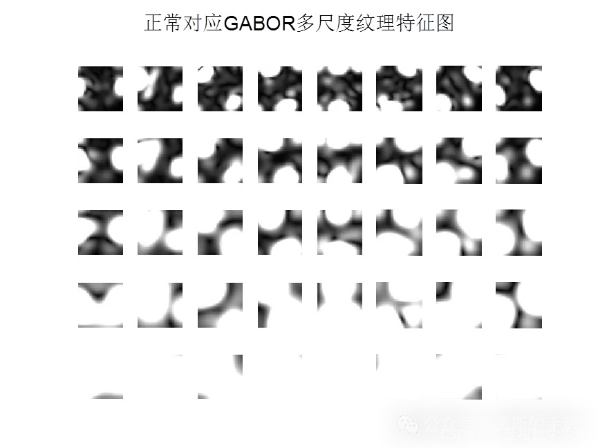 基于Gabor小波特征提取和PSO-SVM的胃溃疡分类（MATLAB R2018a）插图(4)