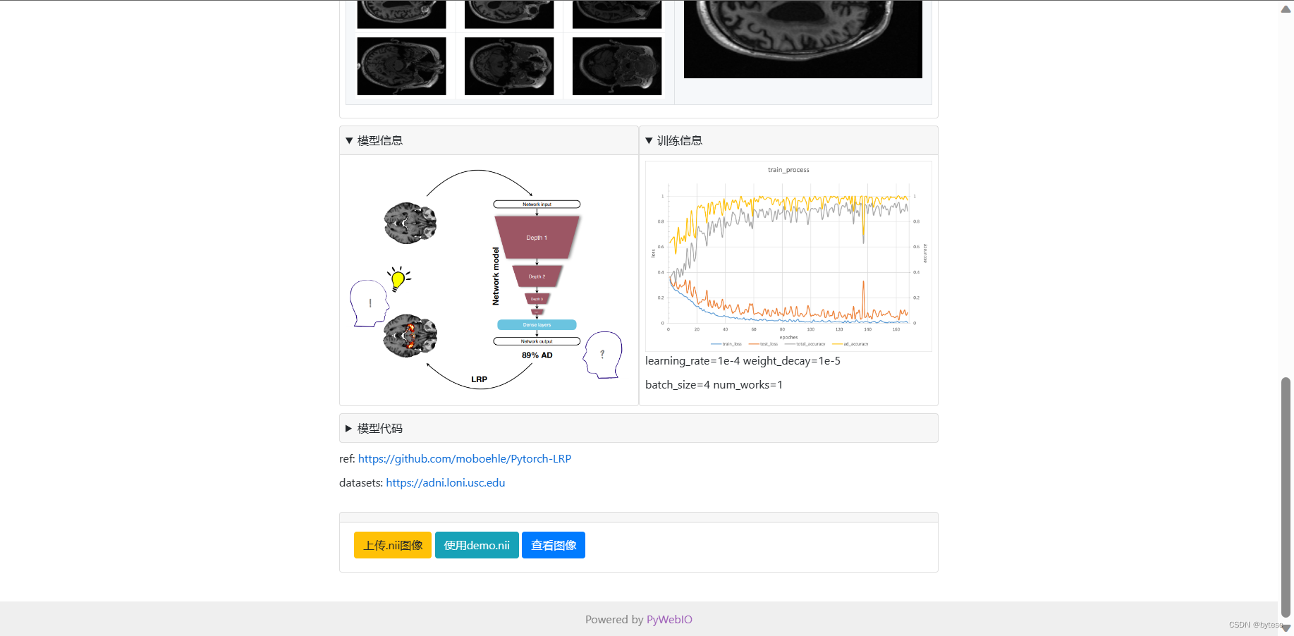 基于 3D 卷积神经网络和 ADNI 数据集的阿尔兹海默智能诊断 Web 应用插图(3)