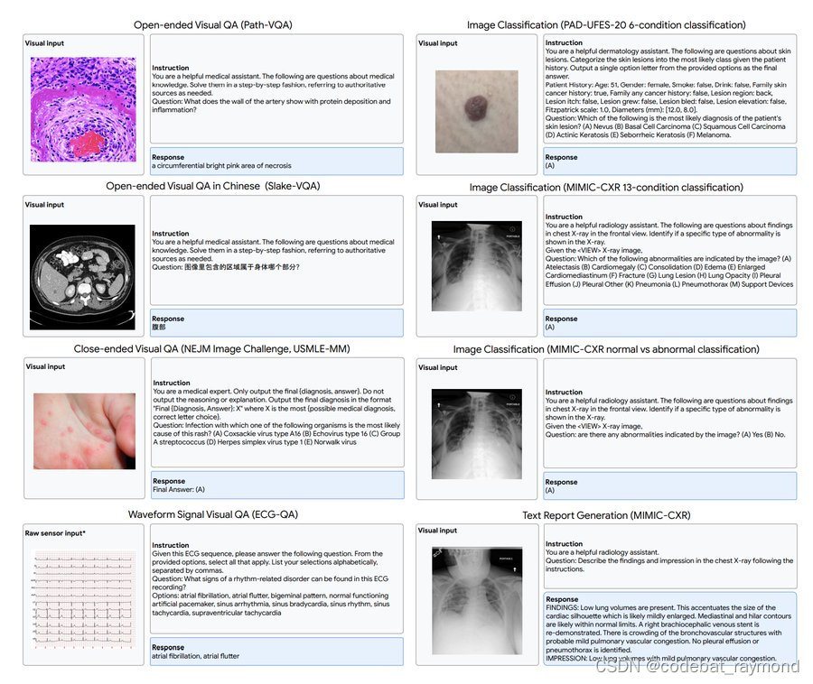 医疗AI的一大步: Google Med-Gemini插图(4)