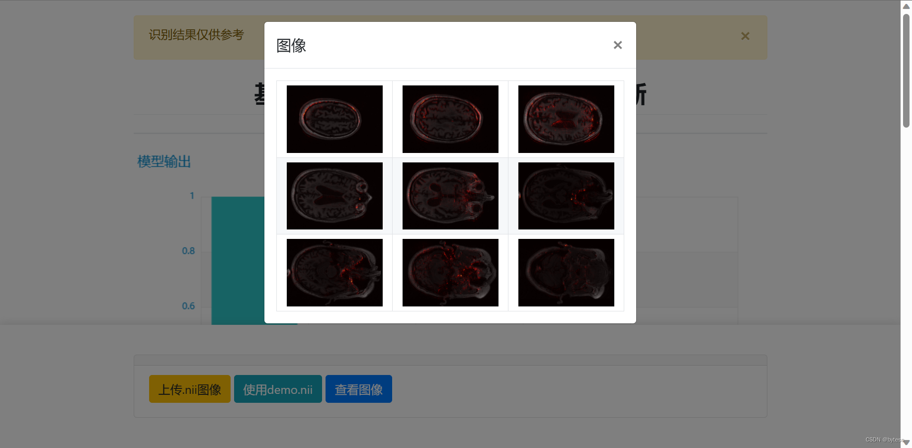 基于 3D 卷积神经网络和 ADNI 数据集的阿尔兹海默智能诊断 Web 应用插图(5)