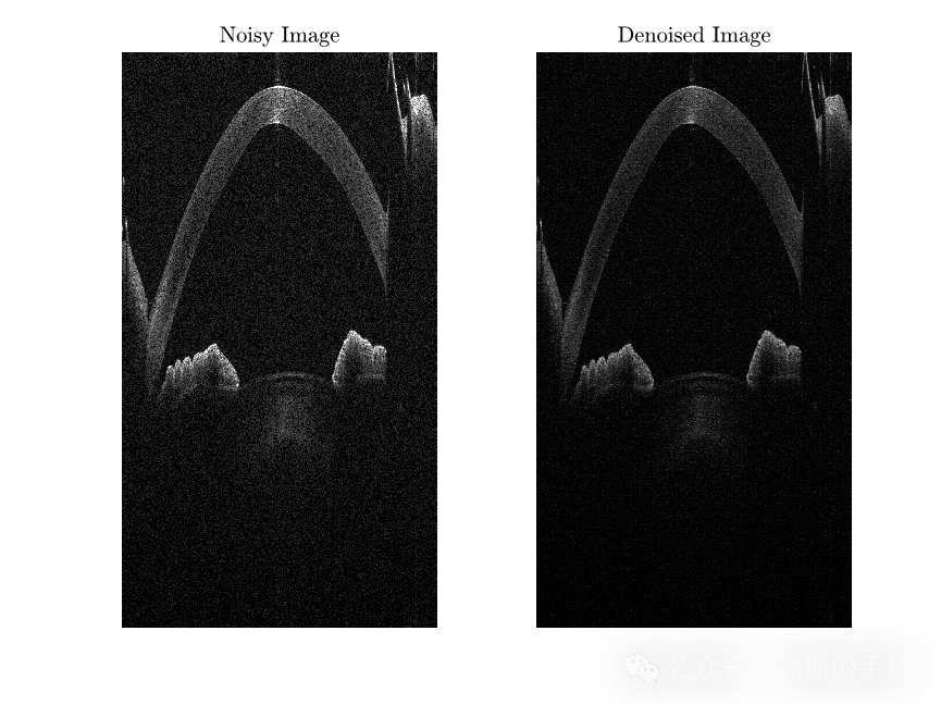 基于小波变换贝叶斯LMMSE估计的图像降噪方法（MATLAB 2018）插图