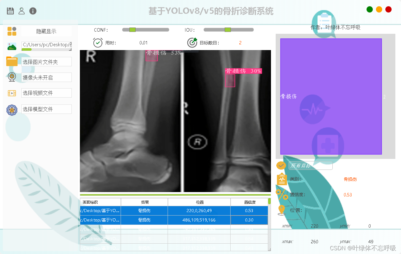 基于深度学习YOLOv8\YOLOv5的骨科骨折诊断检测系统设计插图(2)