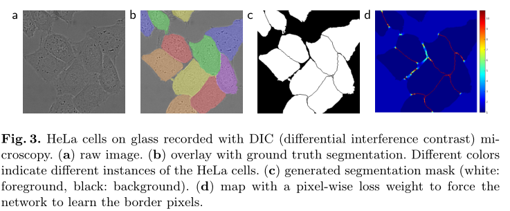 U-Net: Convolutional Networks for Biomedical Image Segmentation–论文笔记插图(2)