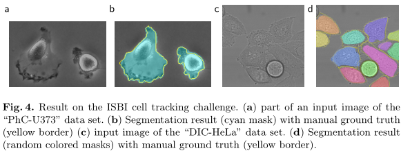 U-Net: Convolutional Networks for Biomedical Image Segmentation–论文笔记插图(7)