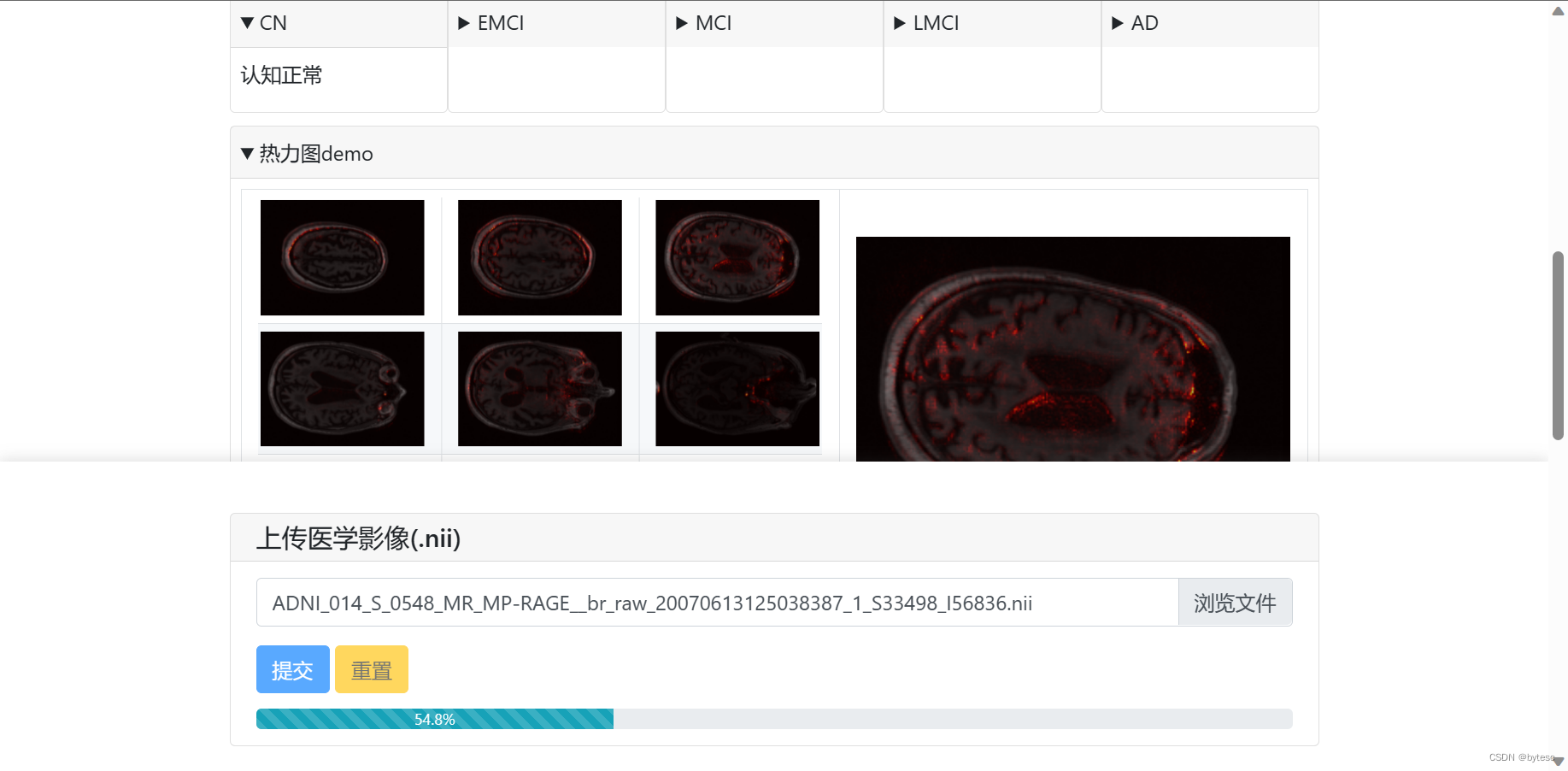 基于 3D 卷积神经网络和 ADNI 数据集的阿尔兹海默智能诊断 Web 应用插图(2)