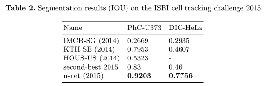 U-Net: Convolutional Networks for Biomedical Image Segmentation–论文笔记插图(8)