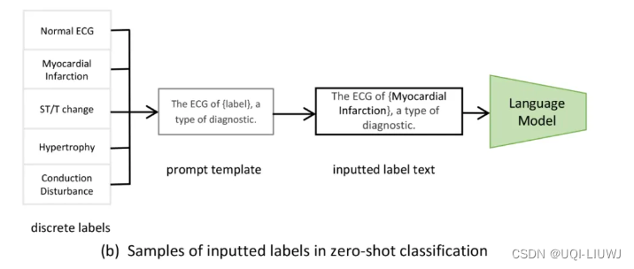 论文笔记：Frozen Language Model Helps ECG Zero-Shot Learning插图(4)