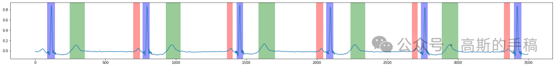 Unet心电信号分割方法（Pytorch）插图(1)