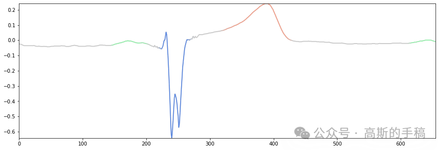 Unet心电信号分割方法（Pytorch）插图(5)