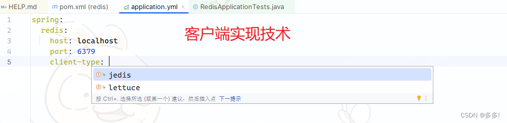 非关系型数据库NoSQL数据层解决方案 之 redis springboot整合与读写操作 2024详解以及window版redis5.0.14下载百度网盘插图(17)